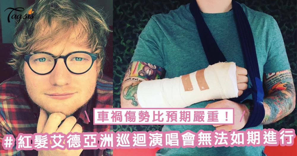 車禍傷勢比預期嚴重！Ed Sheeran亞洲巡迴演唱會將無法如期進行，台北至香港站演唱會都確定會延期！
