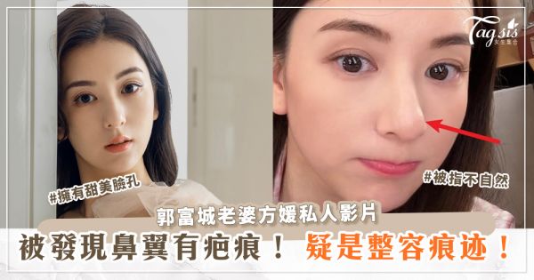 郭富城老婆方媛私人影片，被發現鼻翼有疤痕！疑是整容痕跡！
