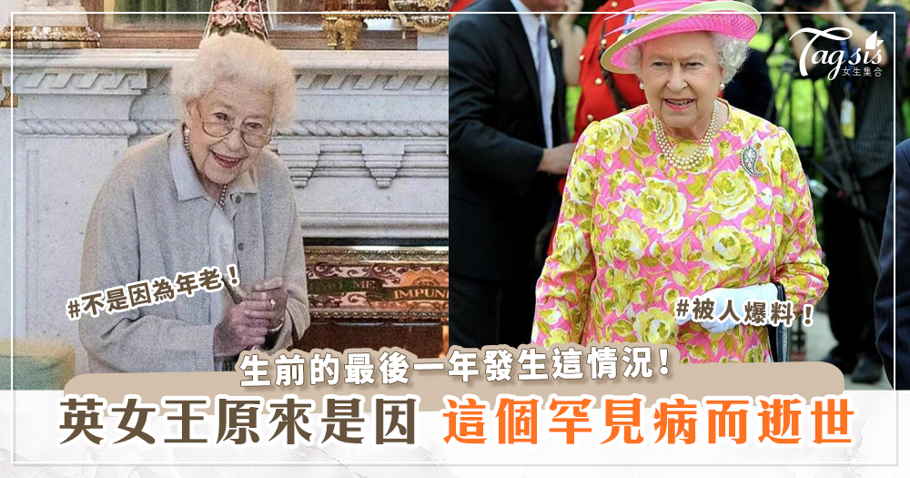 不是因為年老！英女王伊莉莎白原來是因「這個罕見病」而逝世！