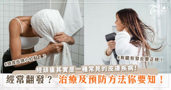 頭瘡其實是一種常見的皮膚疾病！經常翻發？治療及預防方法你要知！