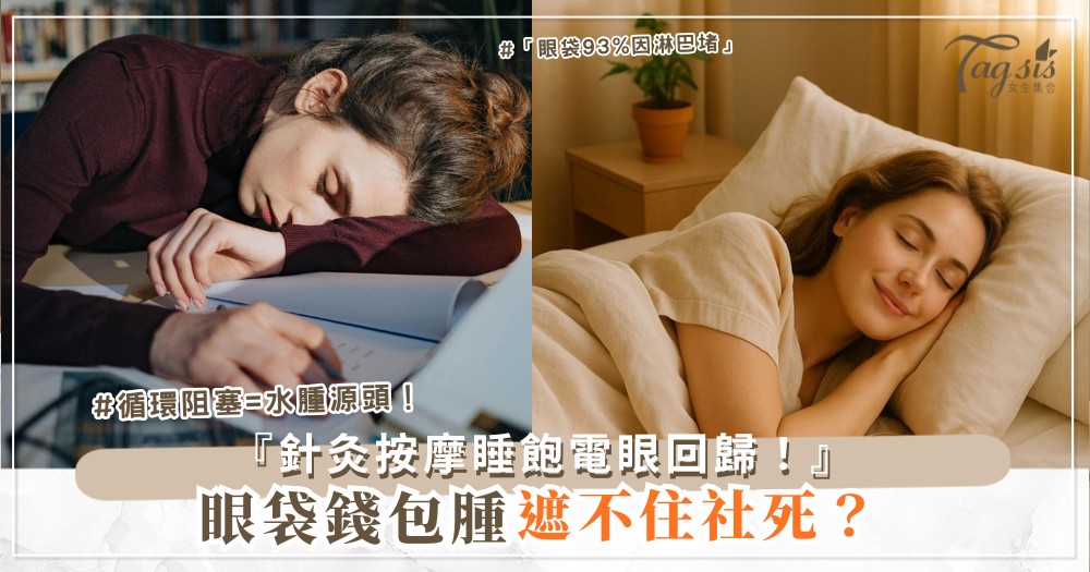 🪙👀 眼袋像錢包？5分鐘針灸按摩，睡飽電眼回歸（第4點太陽穴）