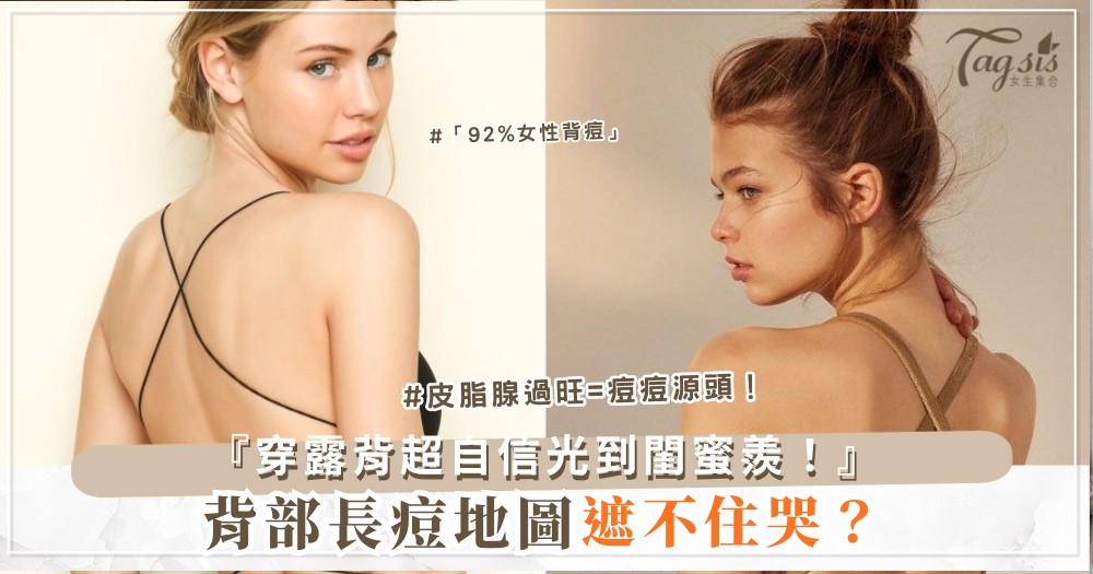 👗✨ 背部長痘遮不住？4天祛痘背心，穿露背超自信（第3款茶樹）