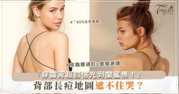 👗✨ 背部長痘遮不住？4天祛痘背心，穿露背超自信（第3款茶樹）